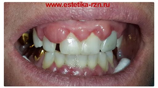 Пародонтология_до