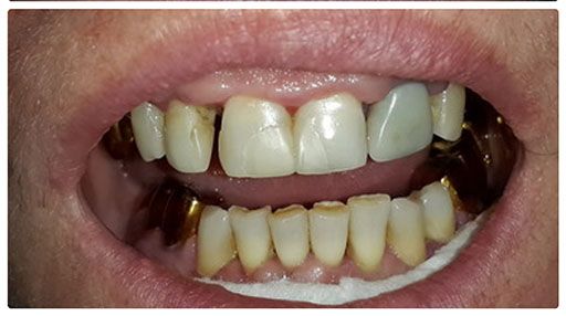 Пародонтология_после